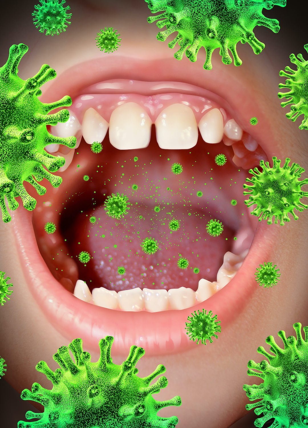 Preventing School Illness in Autistic Children
